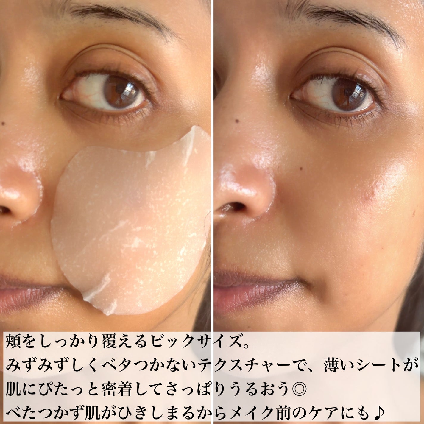 センテラ アンプル/SKIN1004/美容液を使ったクチコミ(8枚目)