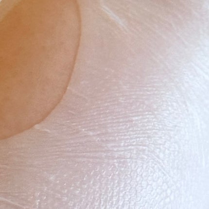 トラブルパッチマスク/EIOM/その他スキンケアを使ったクチコミ(2枚目)