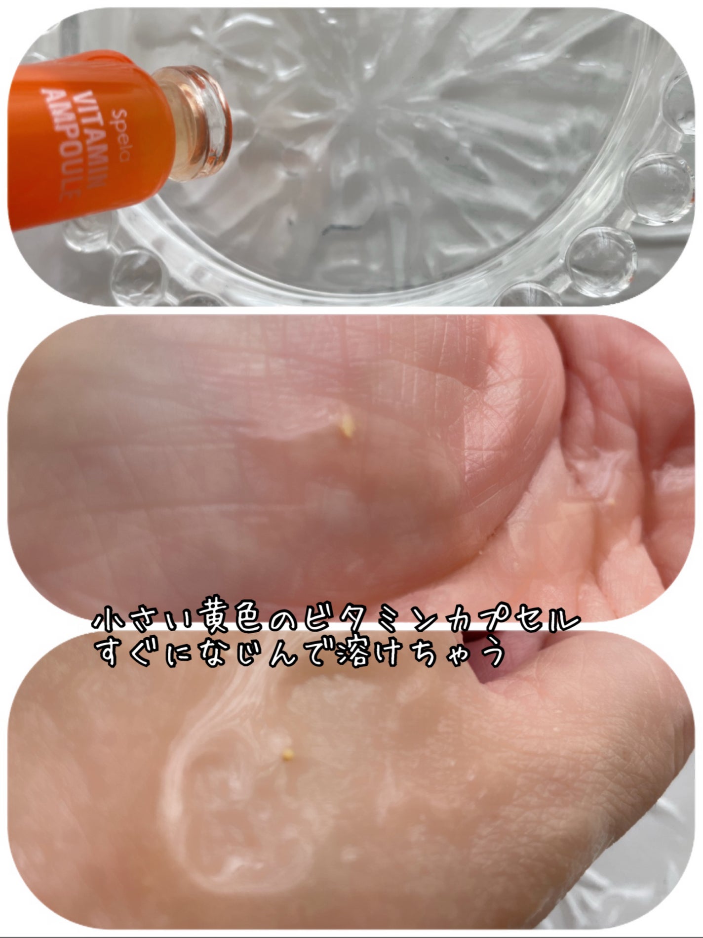 ビタミンアンプル2ml(5本入り)/Spela/美容液を使ったクチコミ(3枚目)