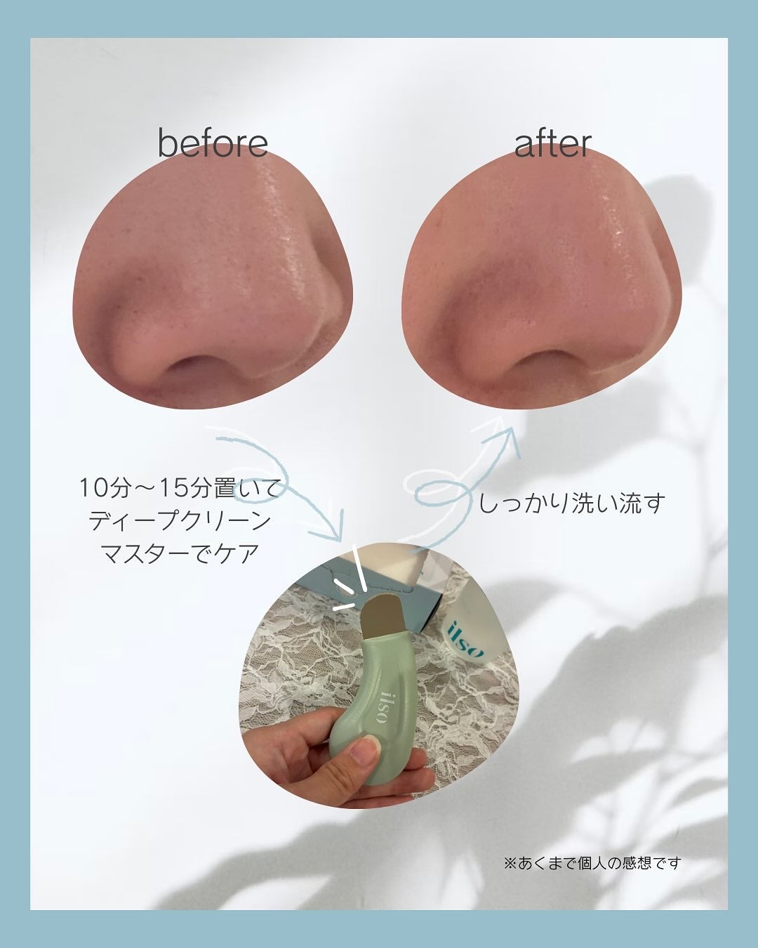 ナチュラルマイルドクリアノーズパック/ilso/シートマスク・パックを使ったクチコミ(3枚目)