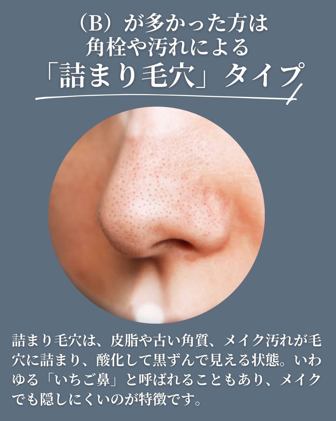asari*老化に抵抗しつづける40代 on LIPS 「\毛穴悩みは3タイプに分かれる/\自分でできるチェック方法/「..」(5枚目)