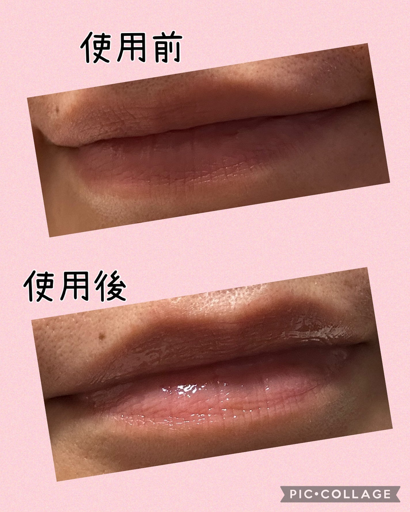 キューミ―ボムショットリッププランパー/AGARISM/リッププランパーを使ったクチコミ(5枚目)