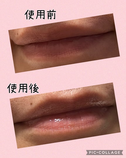 キューミ―ボムショットリッププランパー/AGARISM/リッププランパーを使ったクチコミ(5枚目)