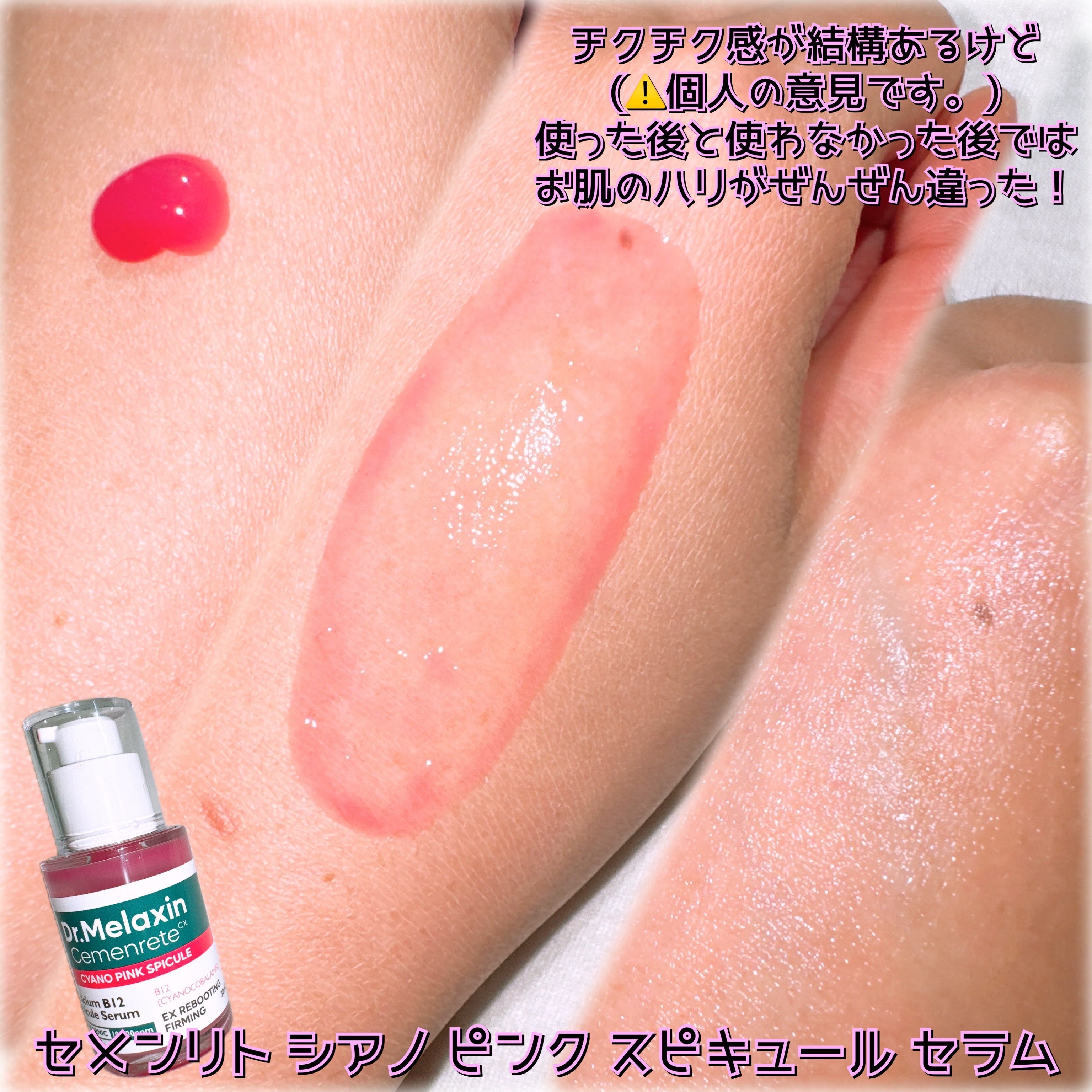 セメンリトシアノ ピンクスピキュールクリー ム/Dr.Melaxin/フェイスクリームを使ったクチコミ（2枚目）