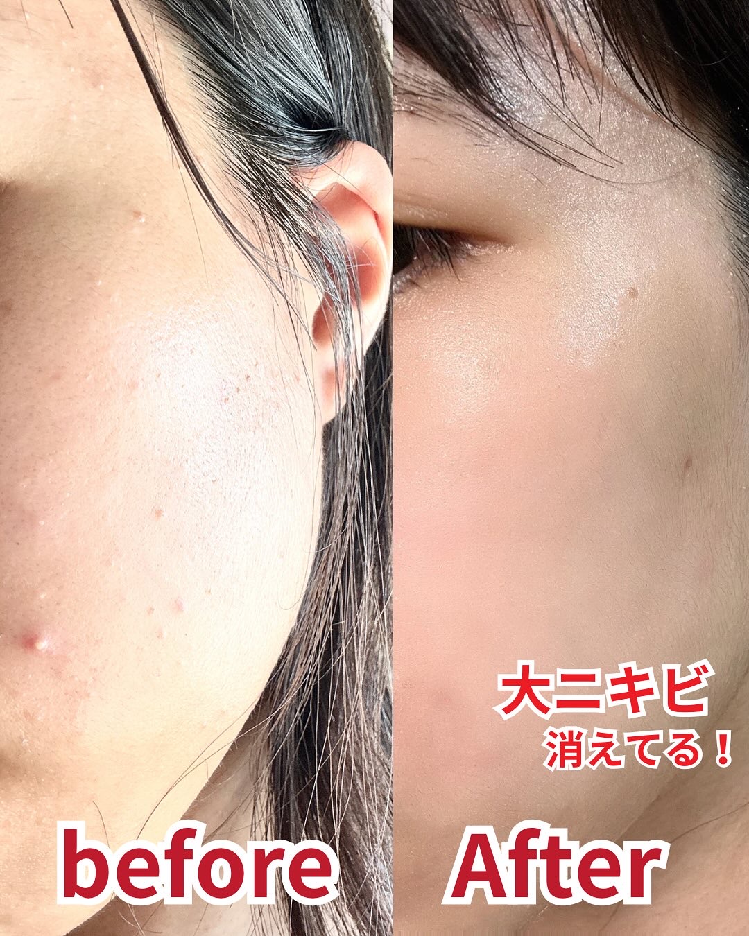 ダーマジェンシー ゼロカ81 セラム/DERMAGENCY/美容液を使ったクチコミ（2枚目）