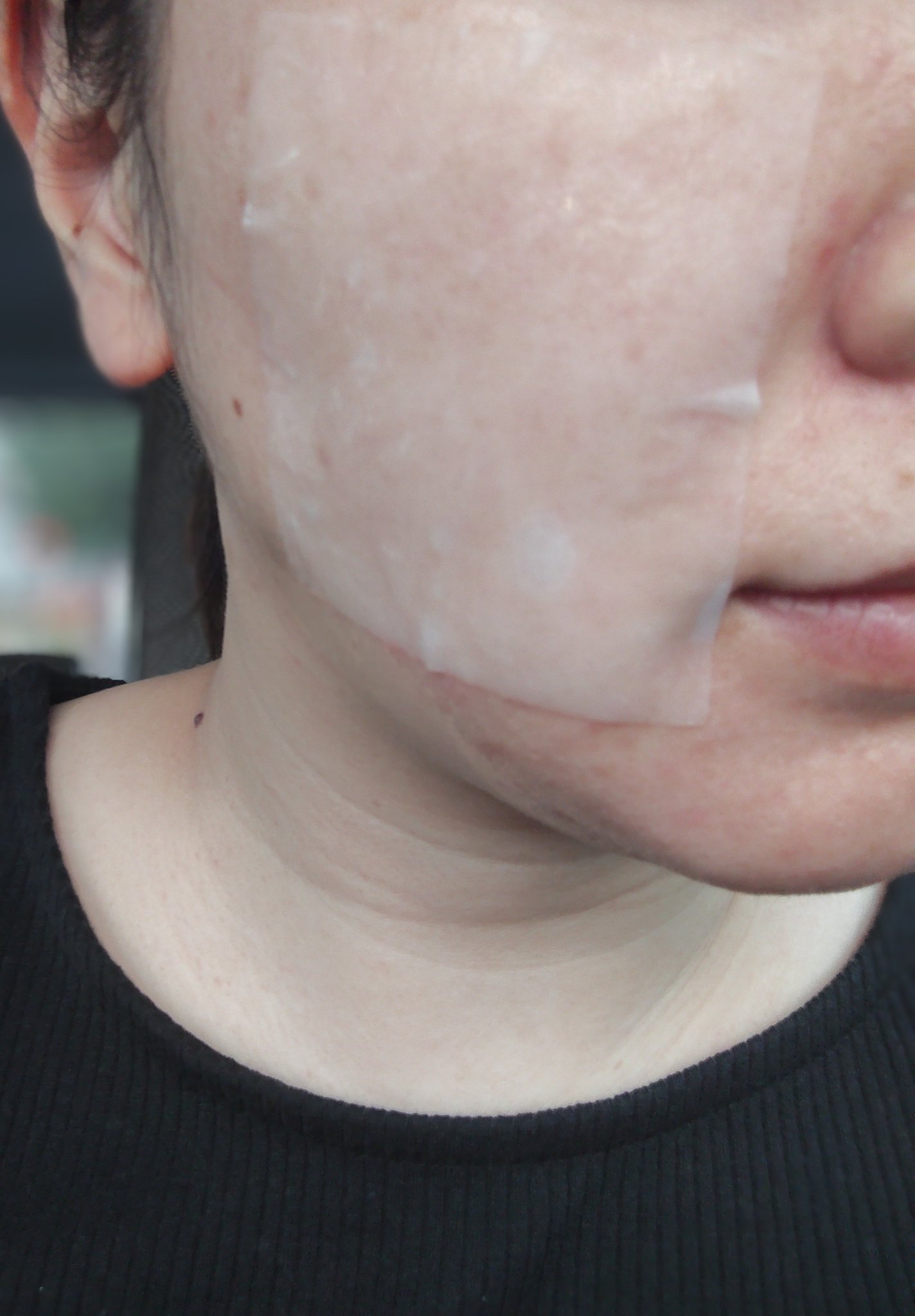 リズム べース ポイント集中パック（シャイン）/RISM/シートマスク・パックを使ったクチコミ（2枚目）