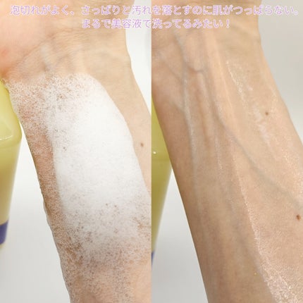 B3 アクネ クリア ボディウォッシュ/b.clinicx/ボディソープを使ったクチコミ(5枚目)