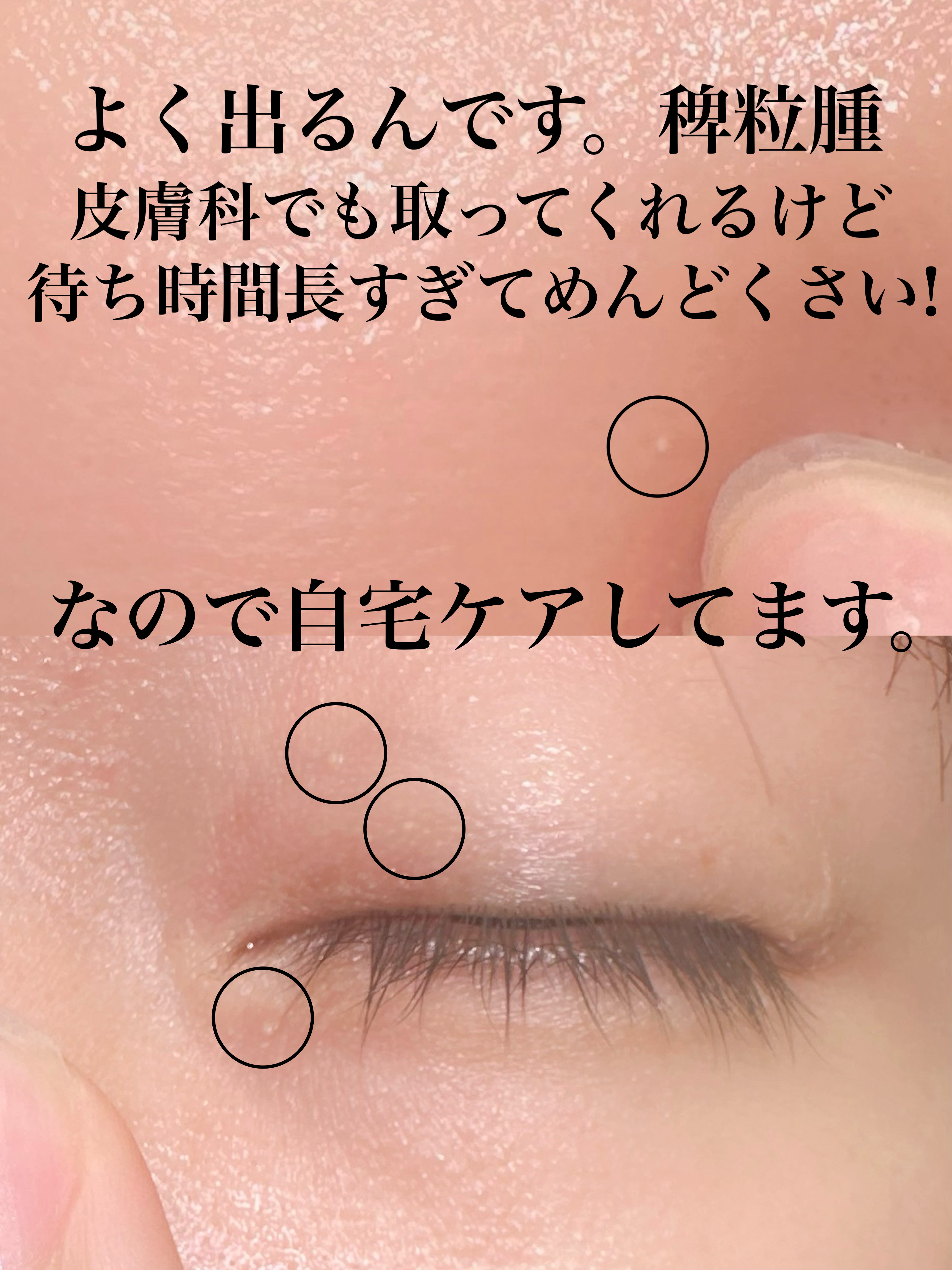 オーガニック ハトムギエキス (ヨクイニン)/KISO/その他を使ったクチコミ（2枚目）