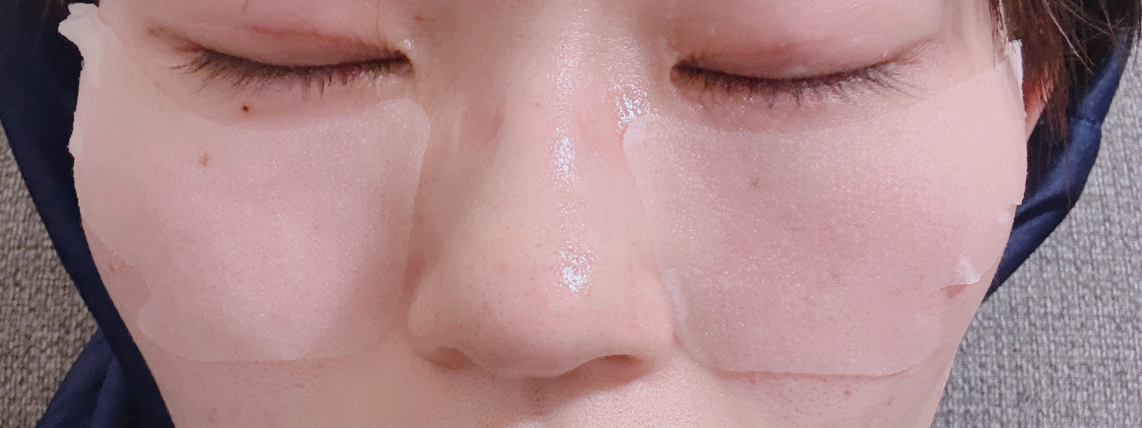 ごめんね素肌　スポットケアマスク/クリアターン/シートマスク・パックを使ったクチコミ（3枚目）