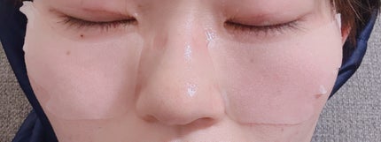 ごめんね素肌 スポットケアマスク/クリアターン/シートマスク・パックを使ったクチコミ(3枚目)