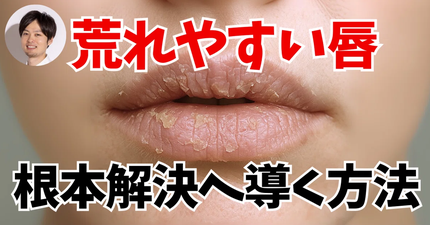 みついだいすけ on LIPS 「唇ケアの最大の盲点は「荒れたら保湿」で終わっていること。乾燥や..」(1枚目)