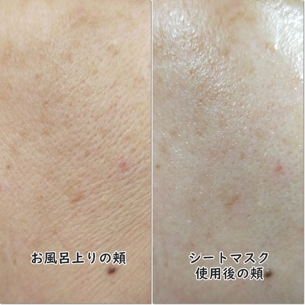 ブラックPDRN デイリーシートマスク/ネイチャーリパブリック/シートマスク・パックを使ったクチコミ(5枚目)