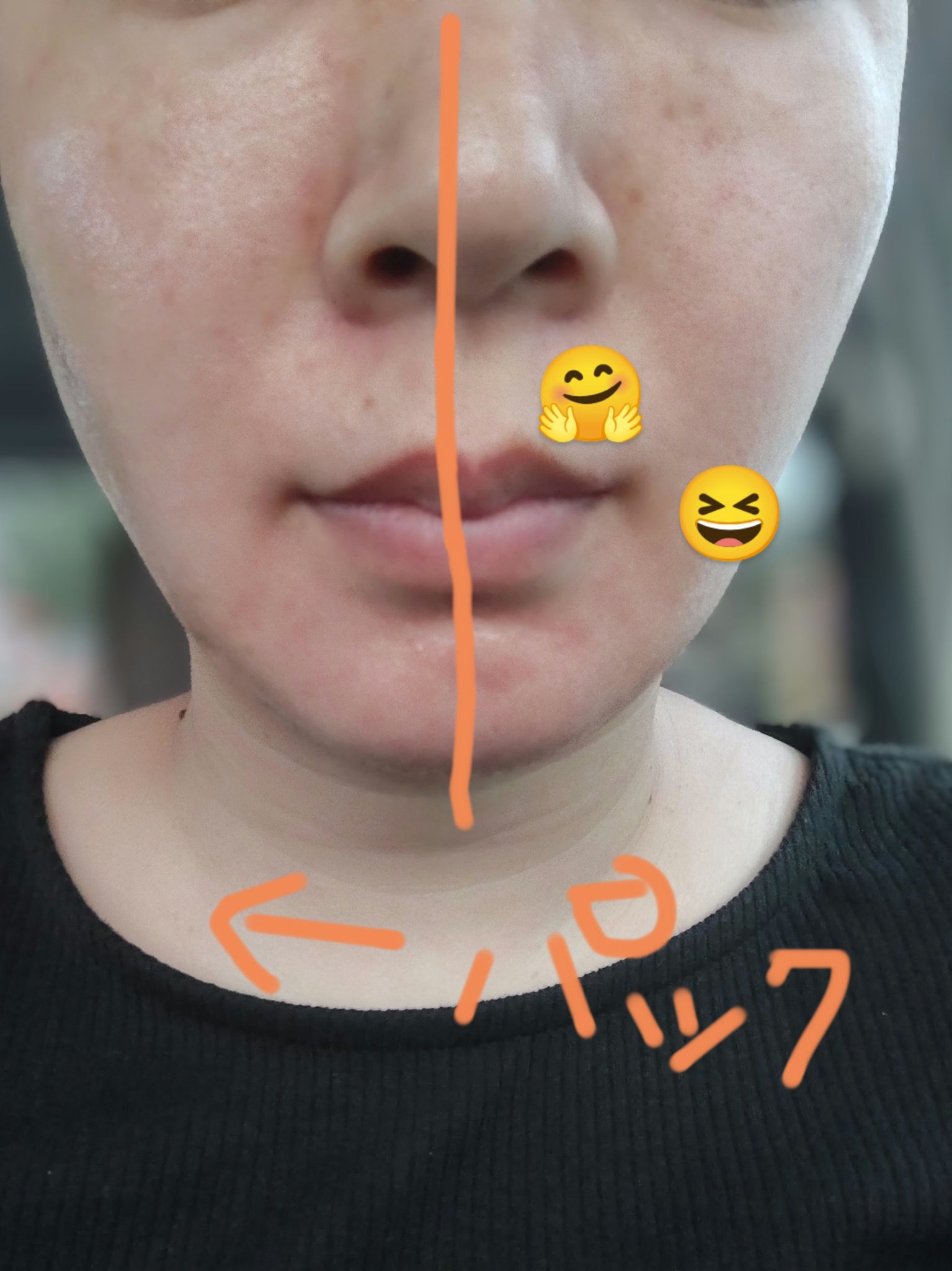 リズム べース ポイント集中パック（シャイン）/RISM/シートマスク・パックを使ったクチコミ（3枚目）