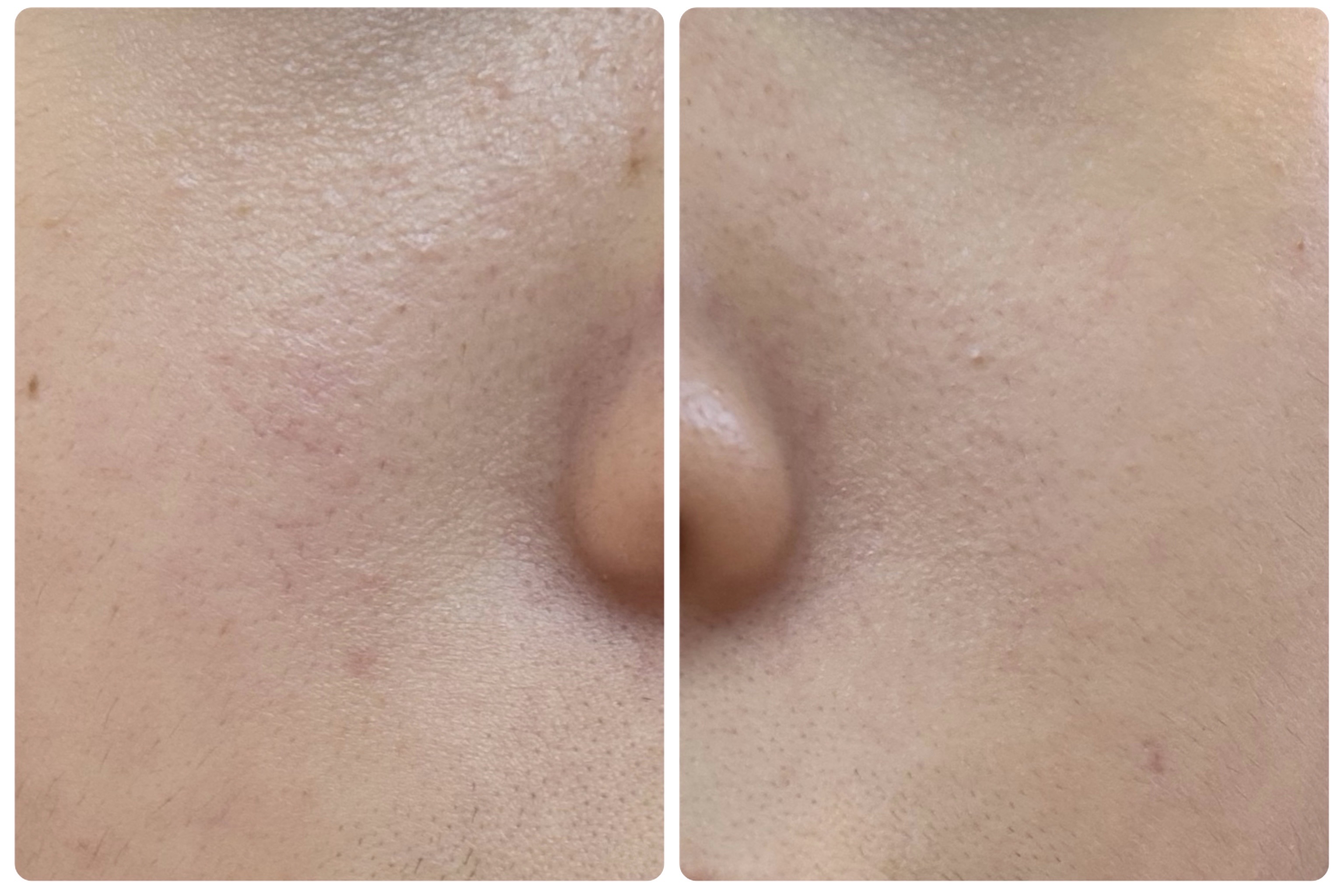 AGE-R ブースタープロ ホワイト（ミニ）/MEDICUBE/美顔器・マッサージを使ったクチコミ（3枚目）