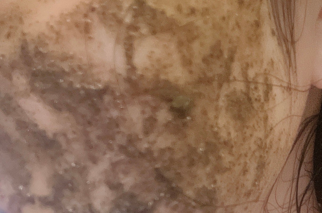 ティーツリーハーブピーリングパック/WellDerma/洗い流すパック・マスクを使ったクチコミ(2枚目)