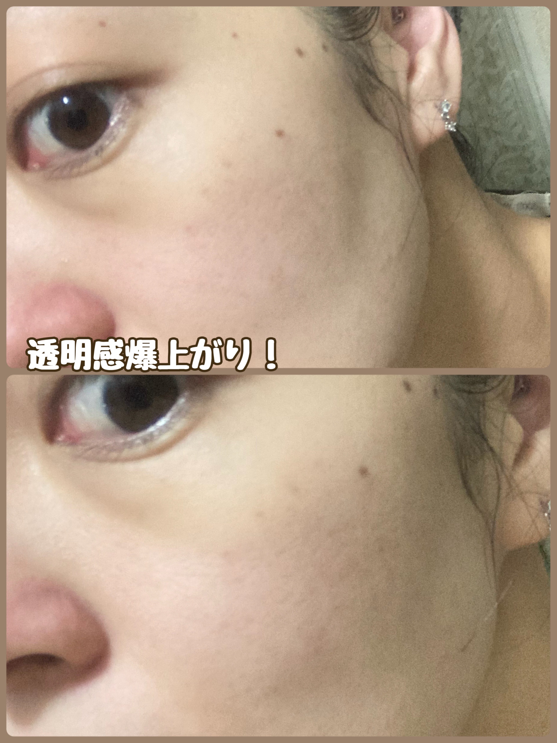 ハトムギ化粧水(ナチュリエ スキンコンディショナー R )/ナチュリエ/化粧水を使ったクチコミ（3枚目）