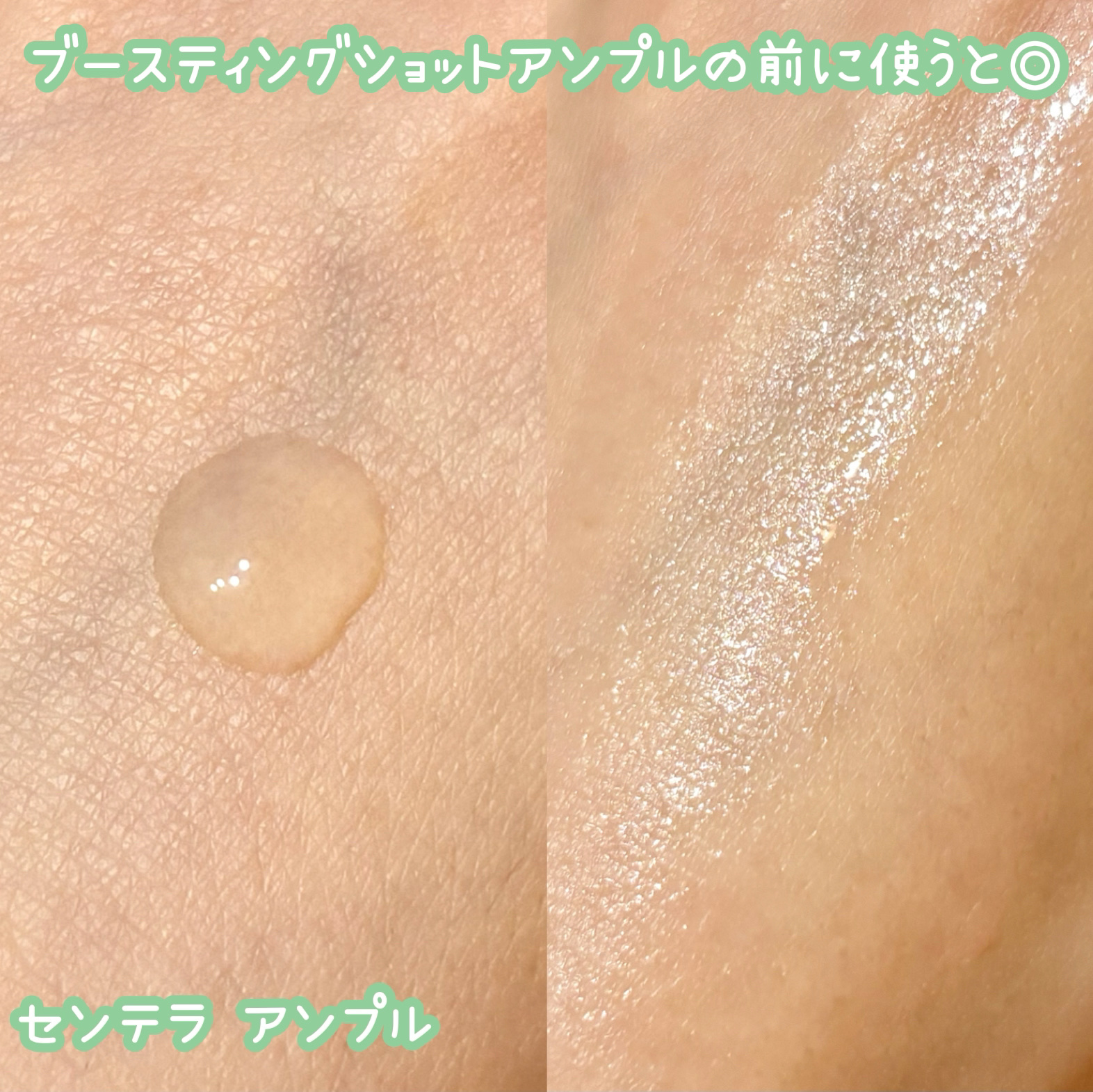 センテラ アンプル/SKIN1004/美容液を使ったクチコミ（2枚目）