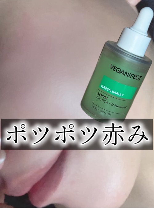 青麦ジンクセラム/Veganifect/美容液を使ったクチコミ（1枚目）