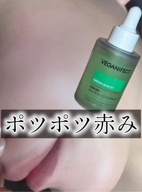 青麦ジンクセラム/Veganifect/美容液を使ったクチコミ(1枚目)