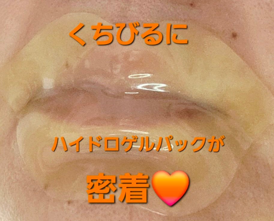 リップパック フルーツシリーズ/CHOOSY/リップマスクを使ったクチコミ(2枚目)