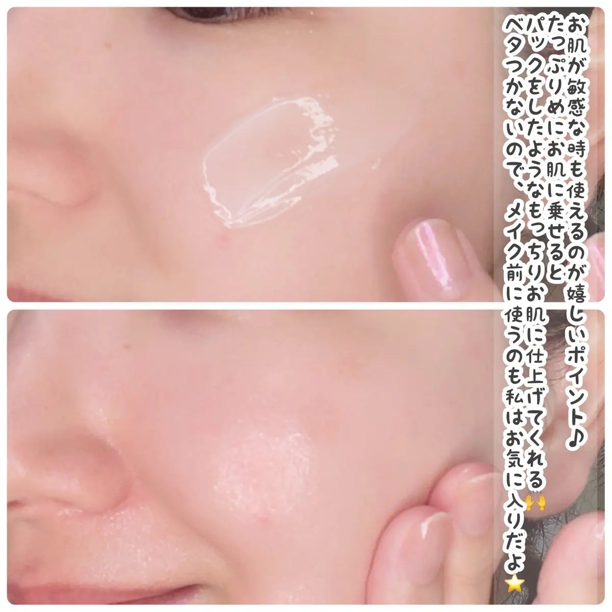 レッドブレミッシュ クリアスージングクリーム/Dr.G/フェイスクリームを使ったクチコミ(3枚目)