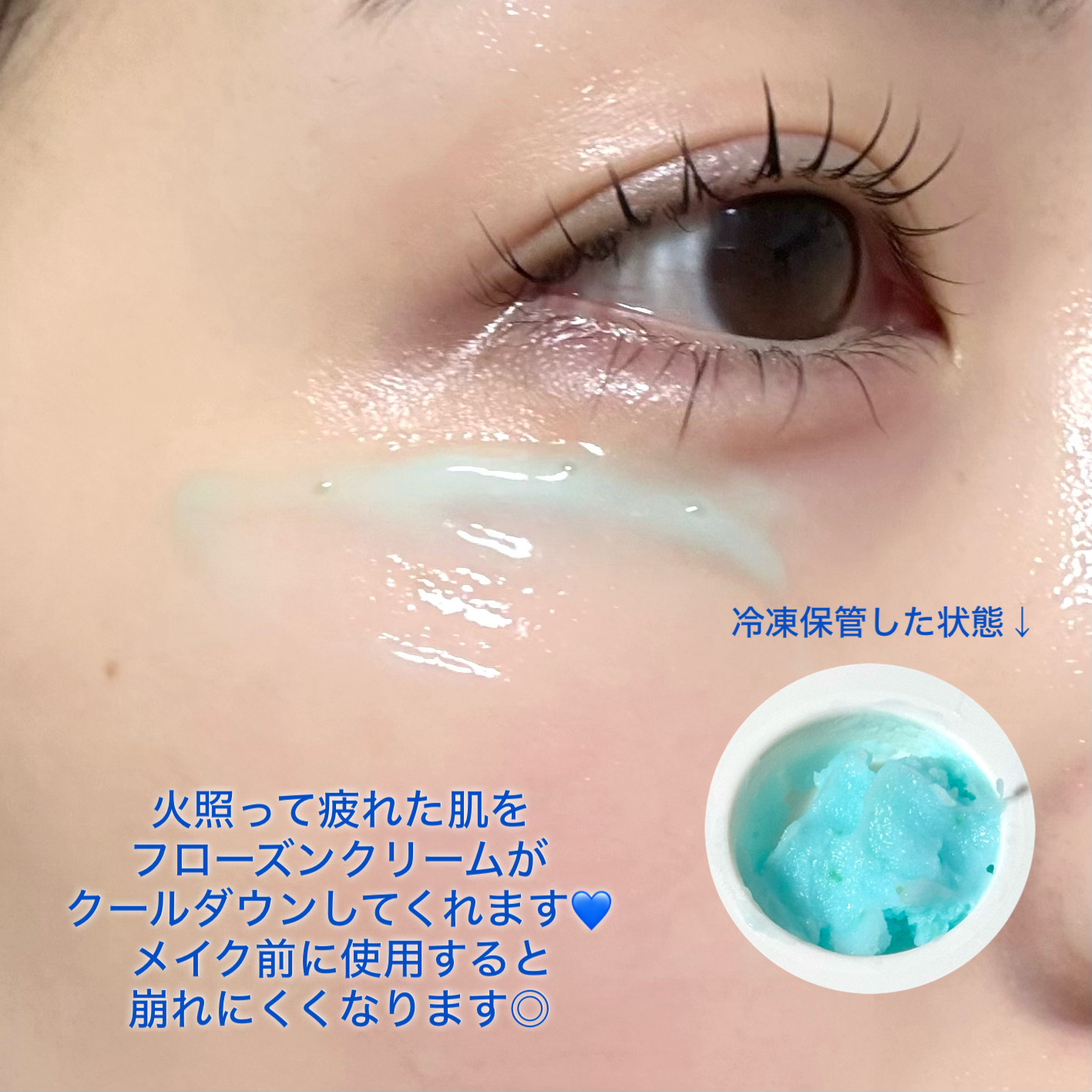 ヒアルロニックフローズンマスク/Celladix/フェイスクリームを使ったクチコミ（2枚目）