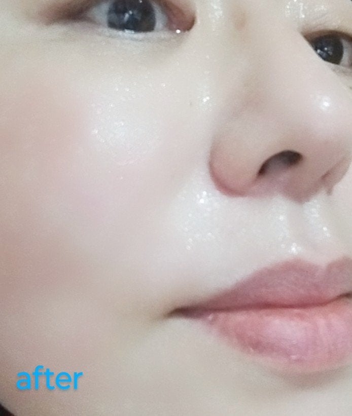 mcgroupakiko on LIPS 「年齢によるお肌のゆらぎや、肌の疲れを感じ始め、肌荒れ対策と美白..」(5枚目)