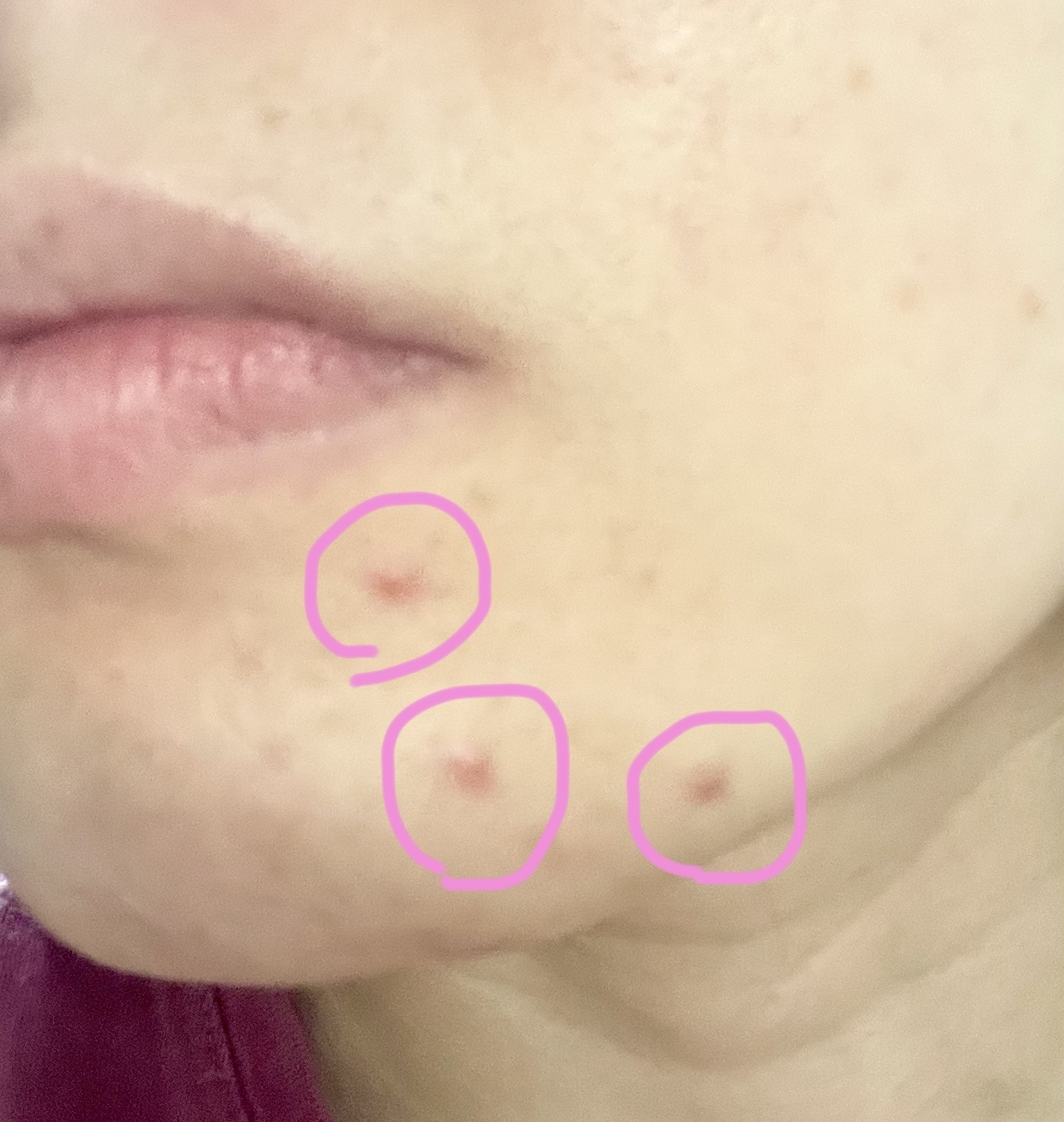 クリアスポットセラム7.325ポンプ/Abib /美容液を使ったクチコミ（3枚目）