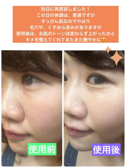 アンリミテッド ケア ツヤ セラム ファンデーション/shu uemura/リキッドファンデーションを使ったクチコミ(4枚目)