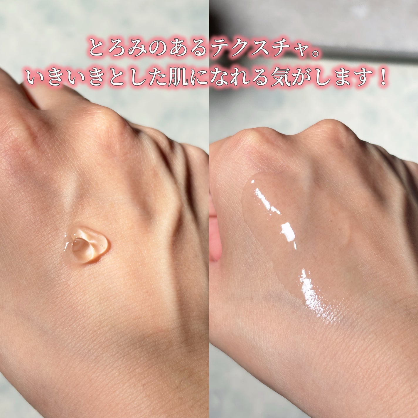 ビタ 5X PDRNセラム/D'amu/美容液を使ったクチコミ(9枚目)