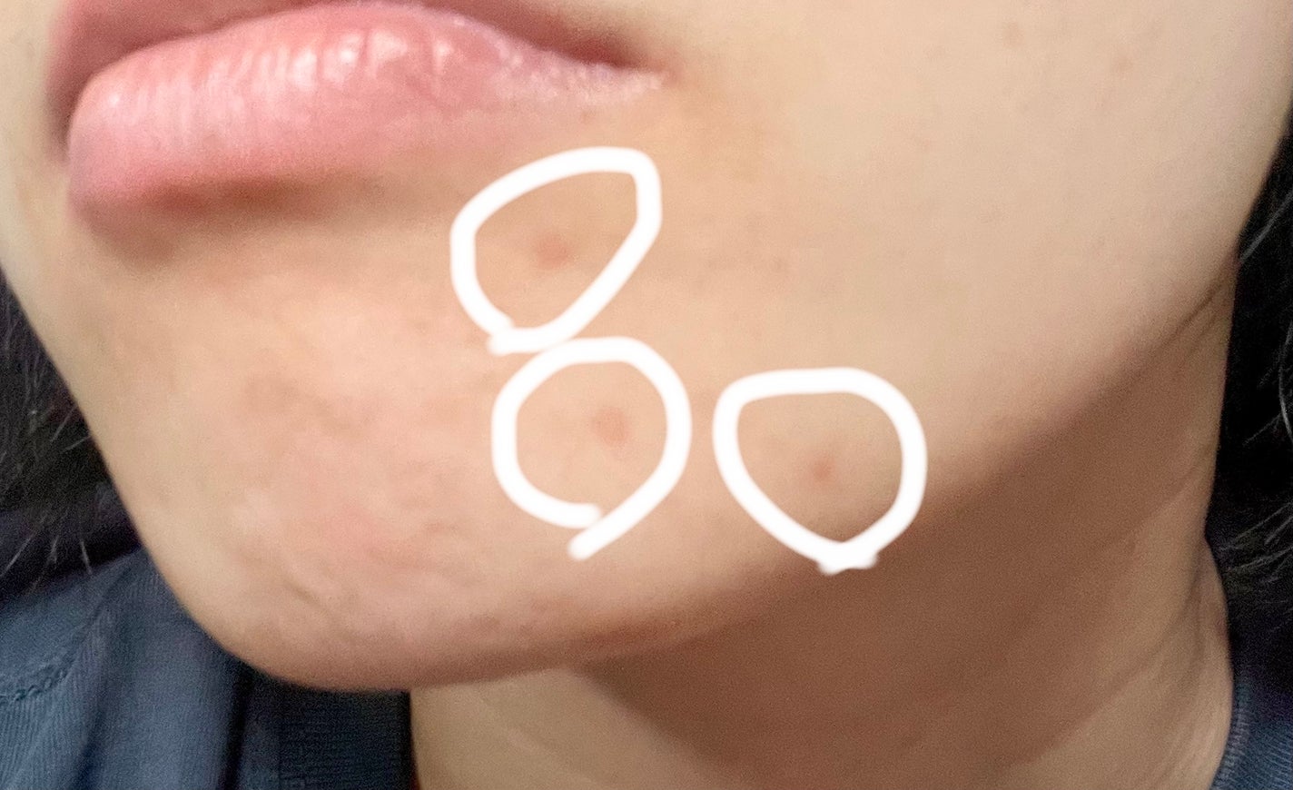 クリアスポットセラム7.325ポンプ/Abib /美容液を使ったクチコミ(4枚目)