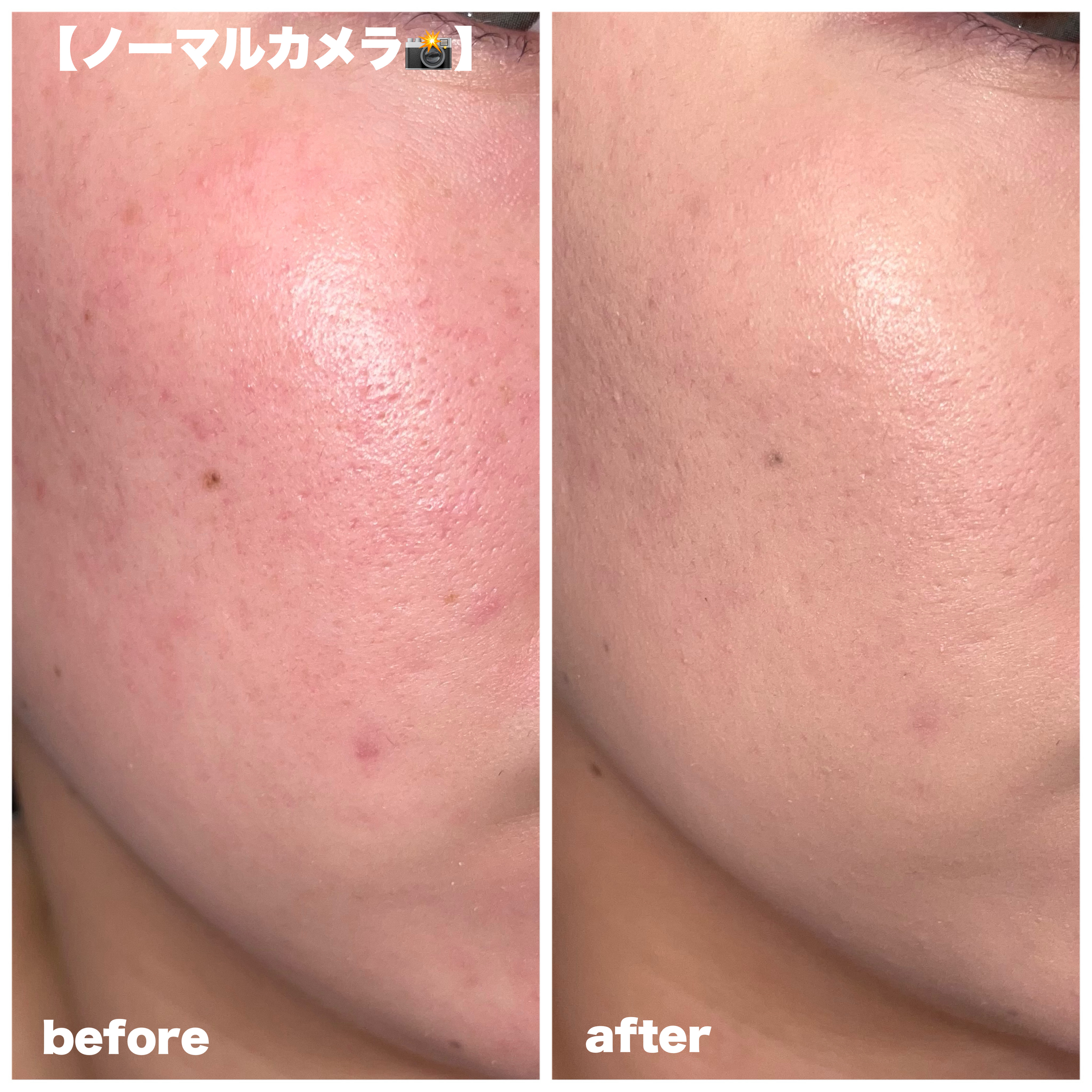 カバーリシャス アルティメット ホワイトクッション/BANILA CO/クッションファンデーションを使ったクチコミ（3枚目）