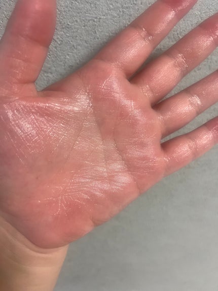 クリアスポットセラム7.325ポンプ/Abib /美容液を使ったクチコミ(4枚目)