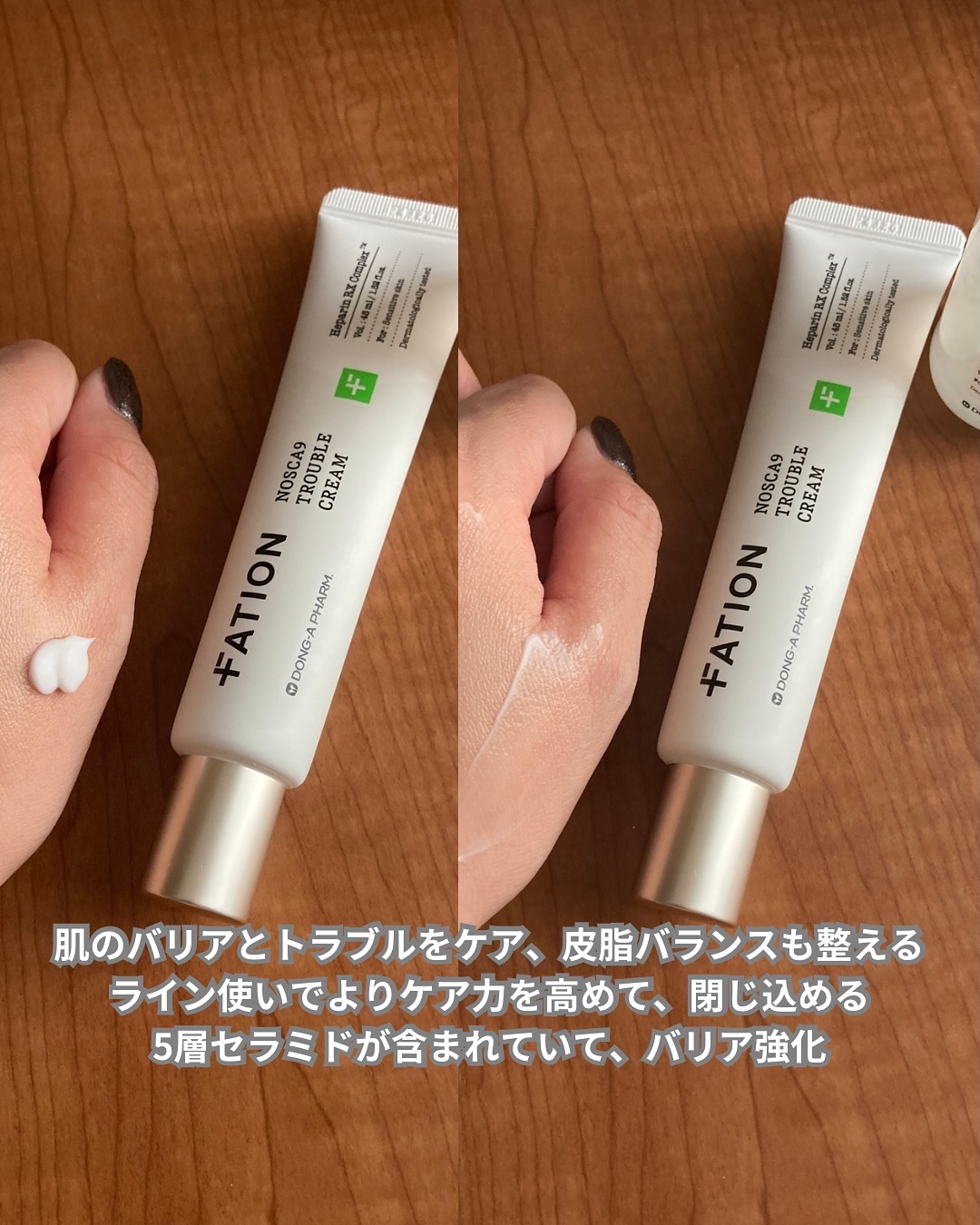 ノスカナイン トラブルクリーム/FATION/フェイスクリームを使ったクチコミ（3枚目）