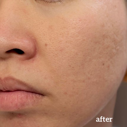 ダーマジェンシー ゼロカ81 クリーム/DERMAGENCY/フェイスクリームを使ったクチコミ(8枚目)