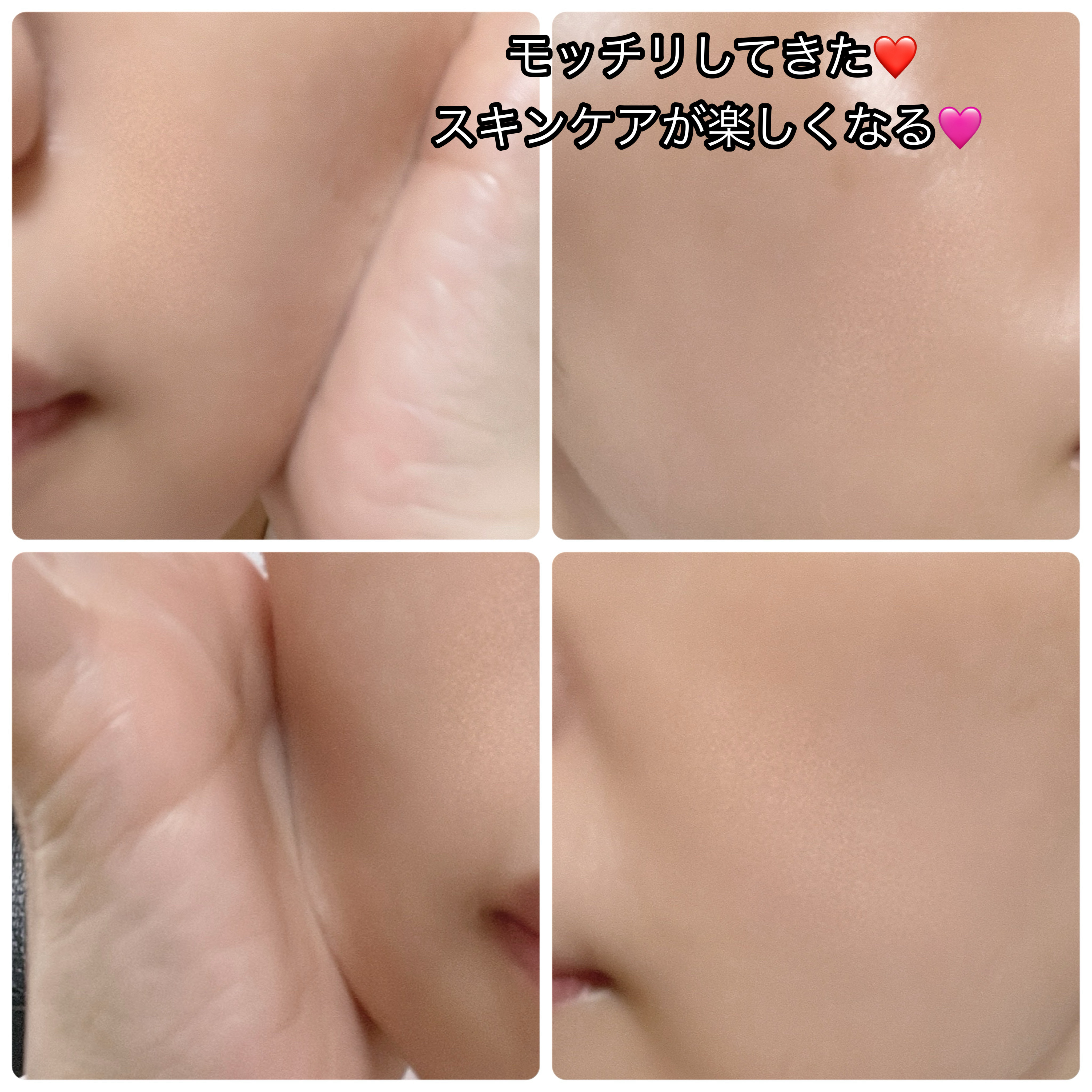 スネイルソリューション スキンブースター(R)/ネイチャーリパブリック/ブースター・導入液を使ったクチコミ（2枚目）