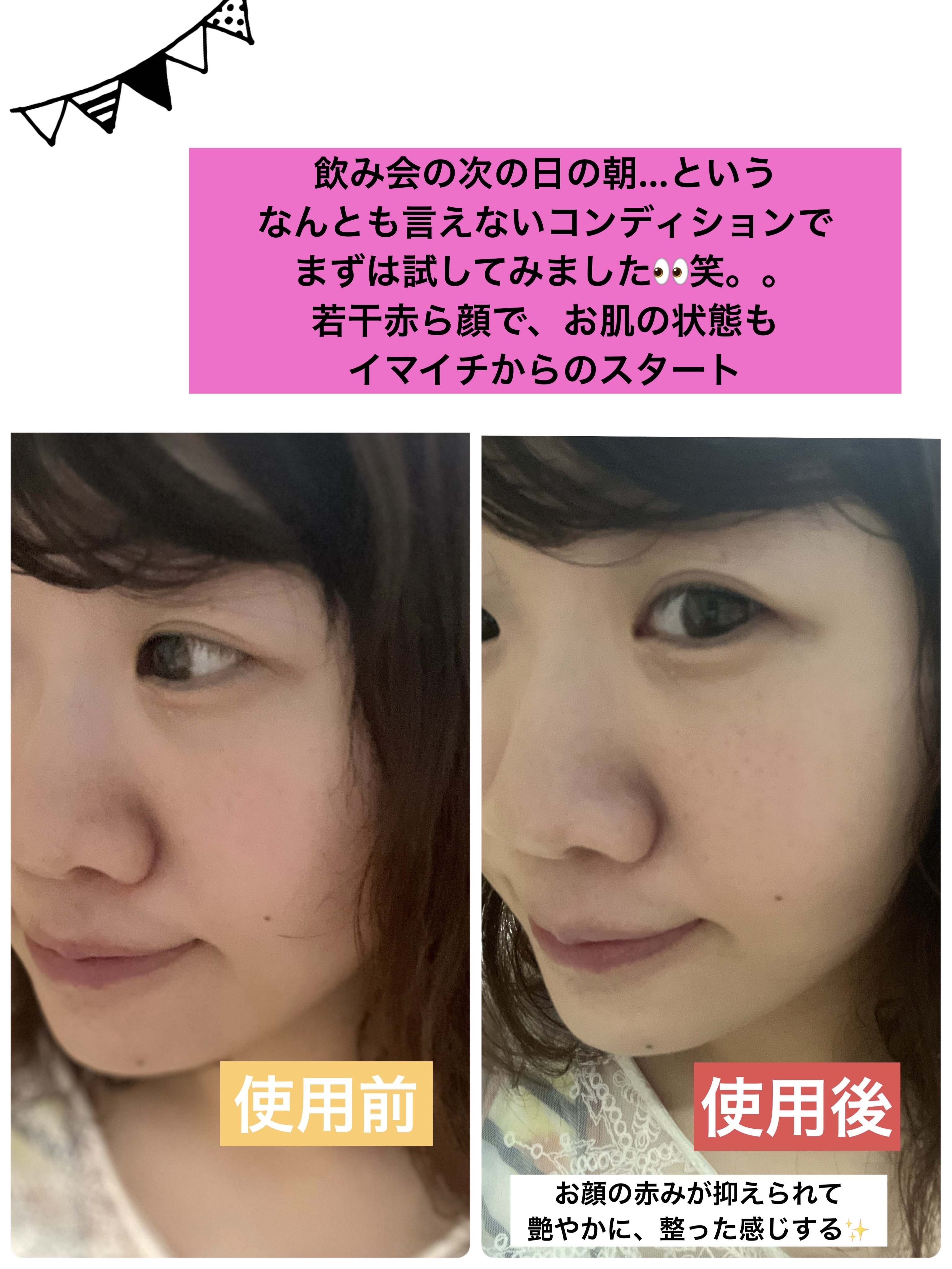 アンリミテッド ケア ツヤ セラム ファンデーション/shu uemura/リキッドファンデーションを使ったクチコミ（3枚目）