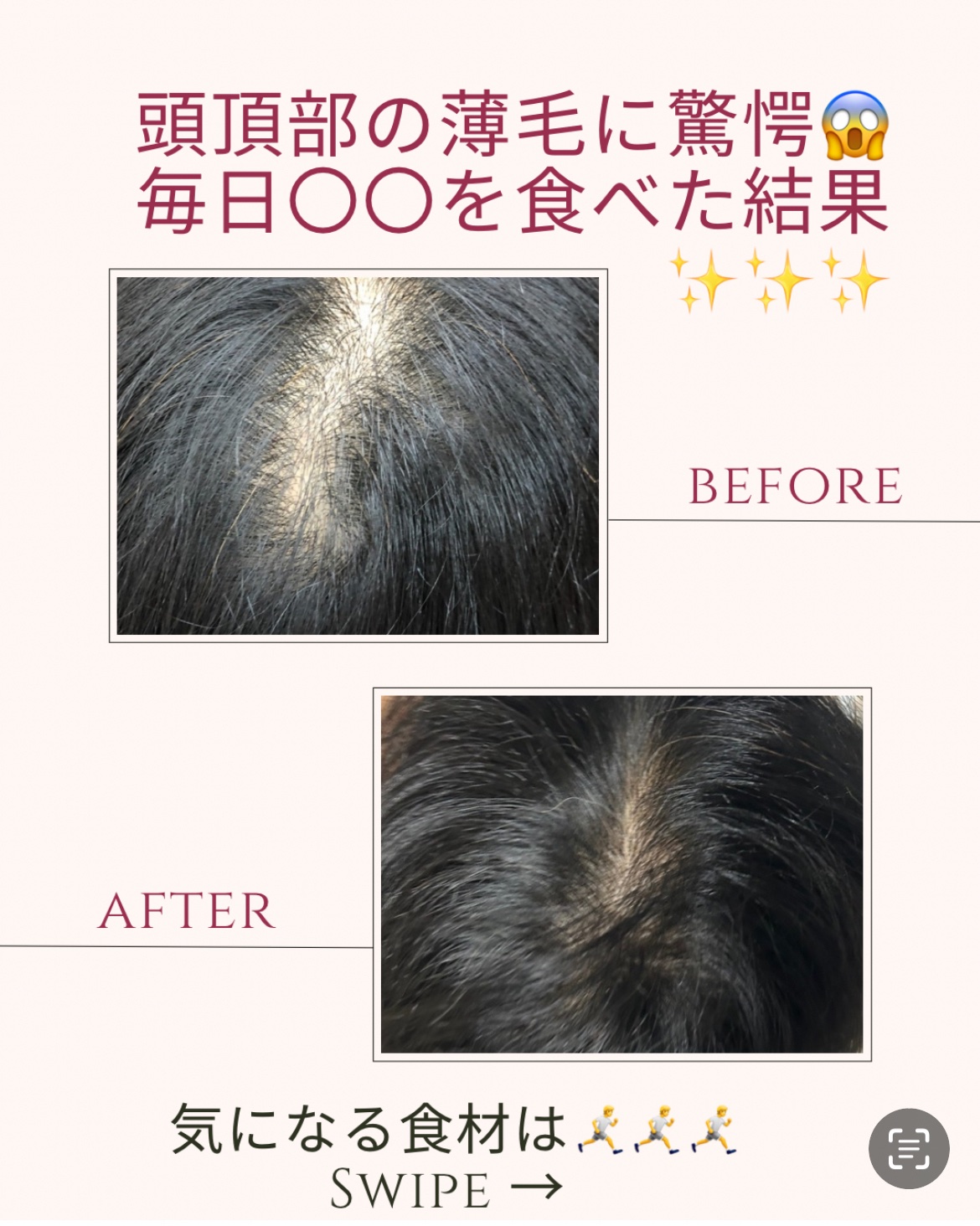 薬用スカルプセラム/wicot/頭皮ローションを使ったクチコミ（1枚目）