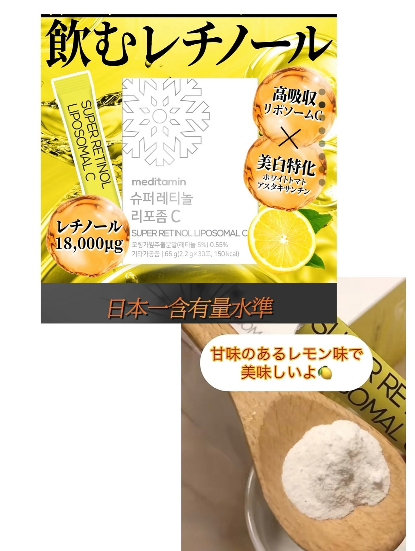 ð¥ð¢ð¬ð.ðððð çŸå®¹ã©ã€ã¿ãŒ on LIPS ã倧奜è©Megakitã®InnerBeautyããŒãžã§ã³ðã¡ã¬å²..ãïŒ4æç®ïŒ