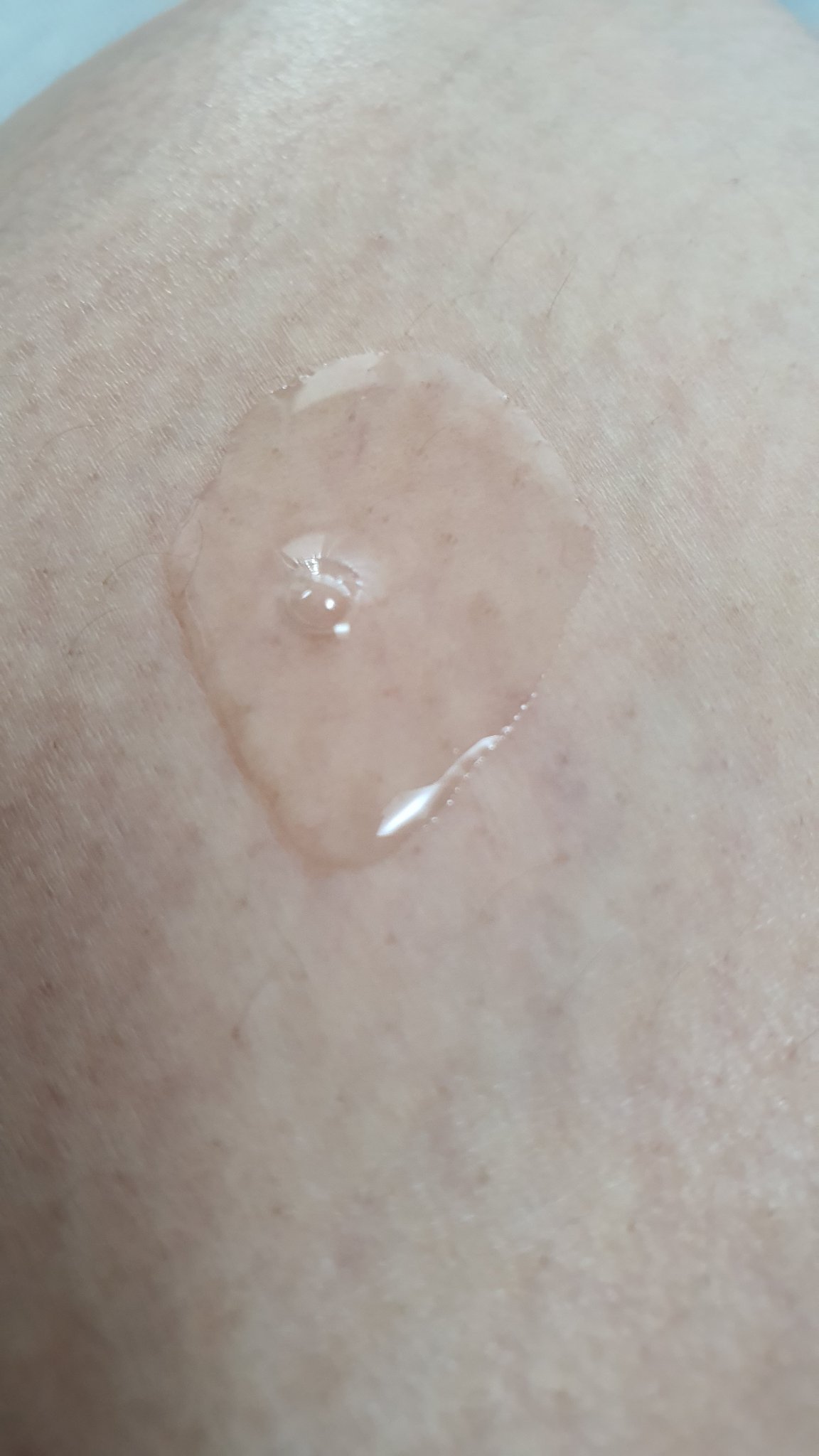 クリアスポットセラム7.325ポンプ/Abib /美容液を使ったクチコミ（3枚目）