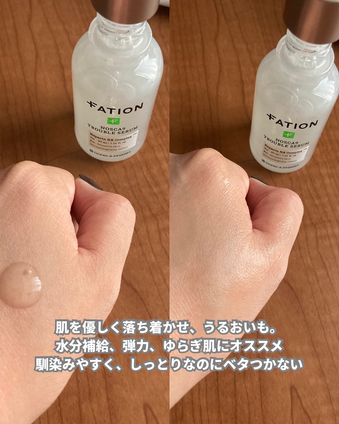 ノスカナイン トラブルクリーム/FATION/フェイスクリームを使ったクチコミ（2枚目）
