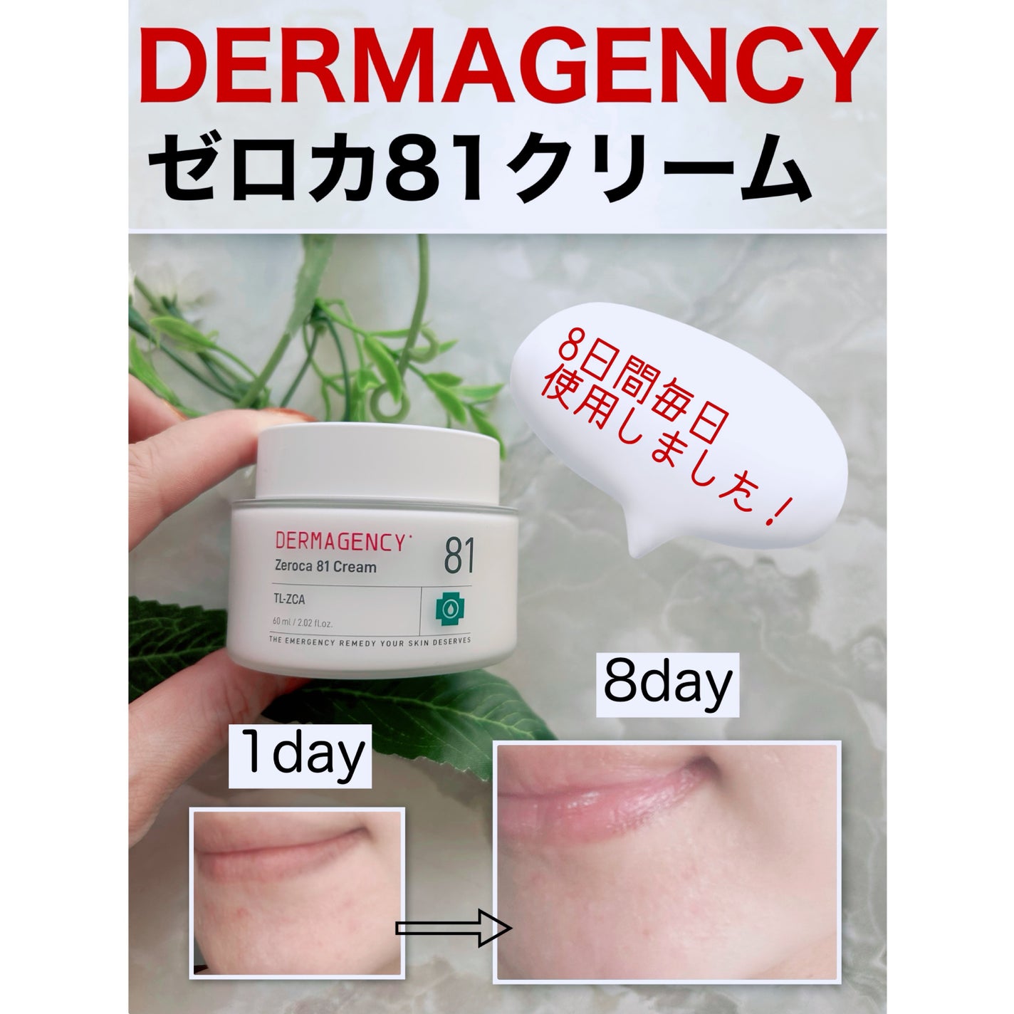 ダーマジェンシー ゼロカ81 クリーム/DERMAGENCY/フェイスクリームを使ったクチコミ(1枚目)