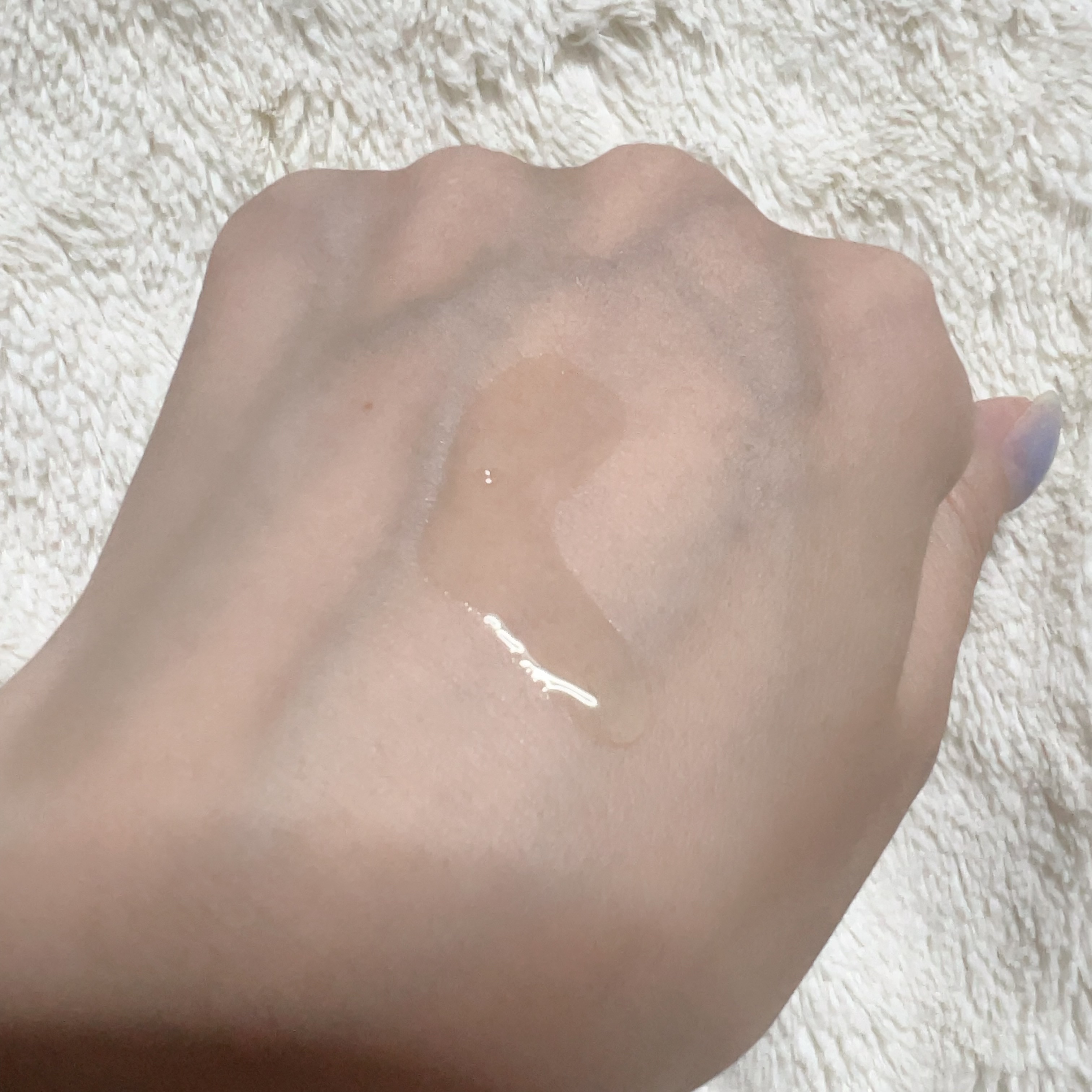 アクネクスアンプル/EIOM/美容液を使ったクチコミ（3枚目）