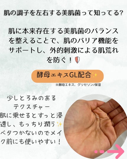 モイストケア ローション MB/d プログラム/化粧水を使ったクチコミ(3枚目)