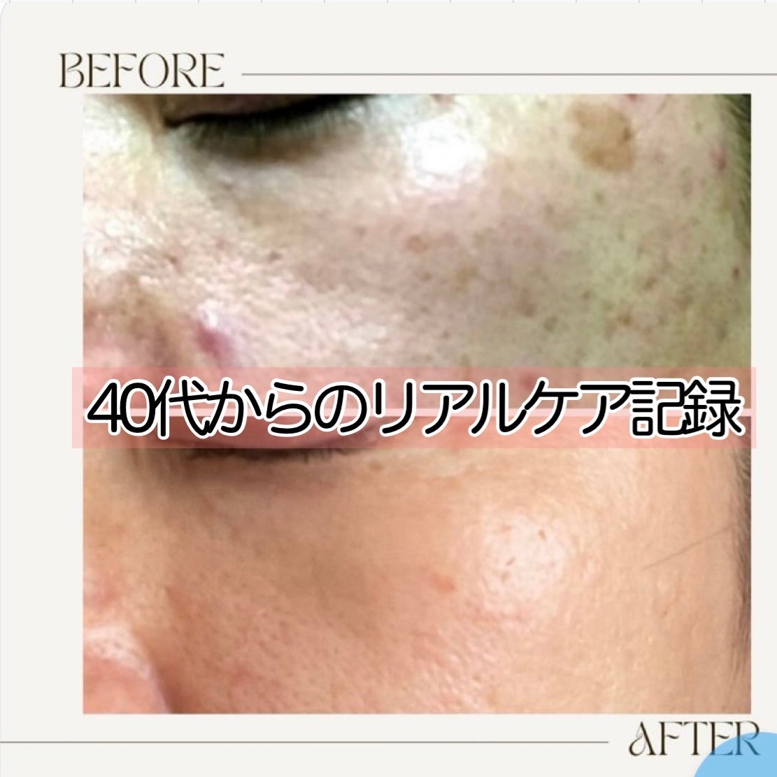 メラノフォーカスZ/HAKU/美容液を使ったクチコミ(1枚目)