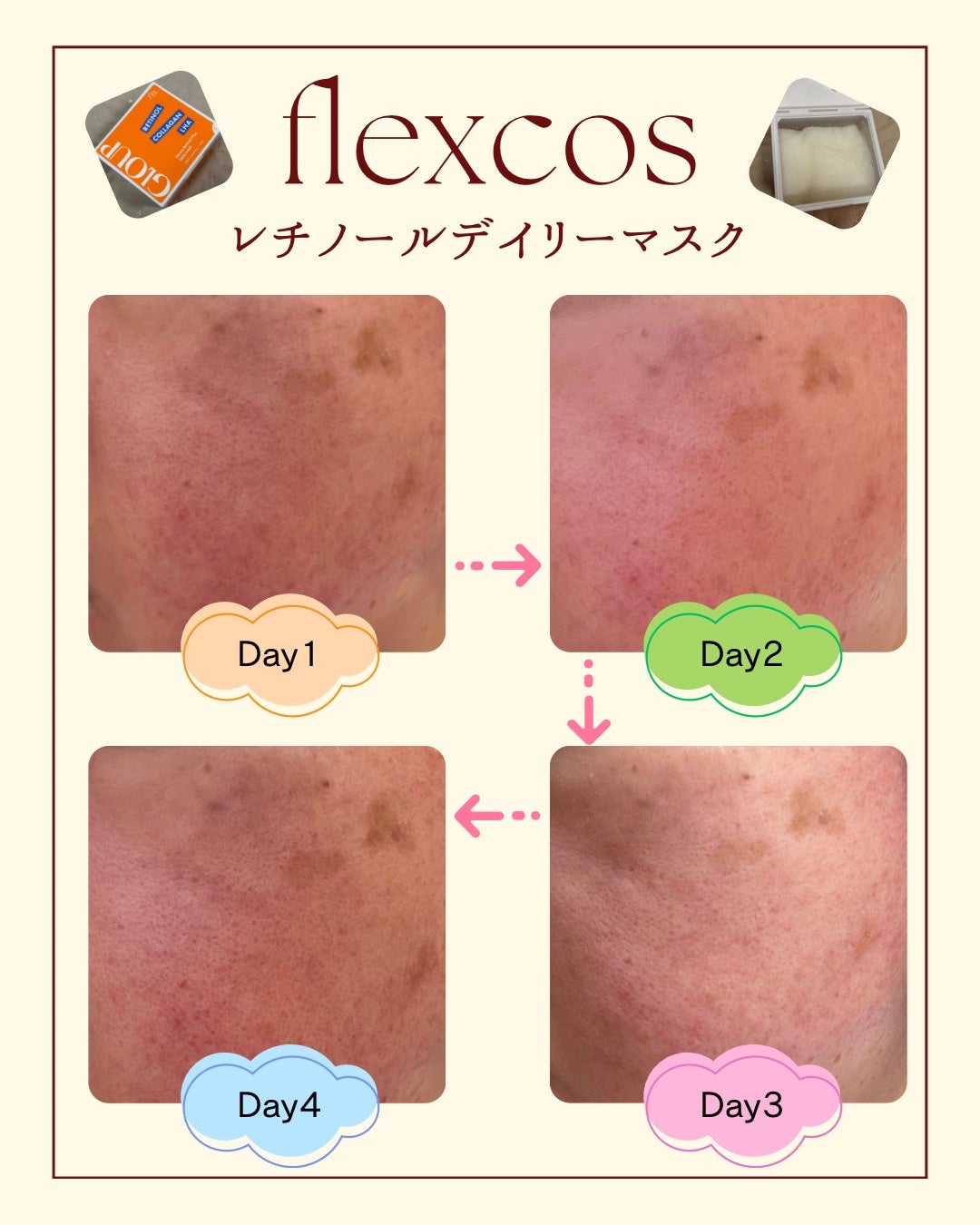GLOUP DERMA RETINOL PLUS DAILY MASK/flexcos/シートマスク・パックを使ったクチコミ(5枚目)
