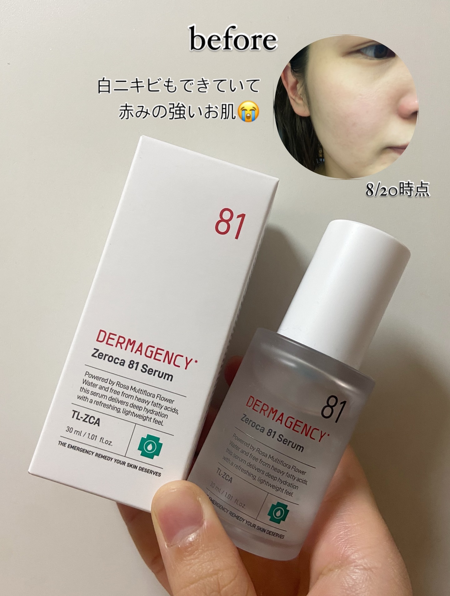 ダーマジェンシー ゼロカ81 セラム/DERMAGENCY/美容液を使ったクチコミ（2枚目）