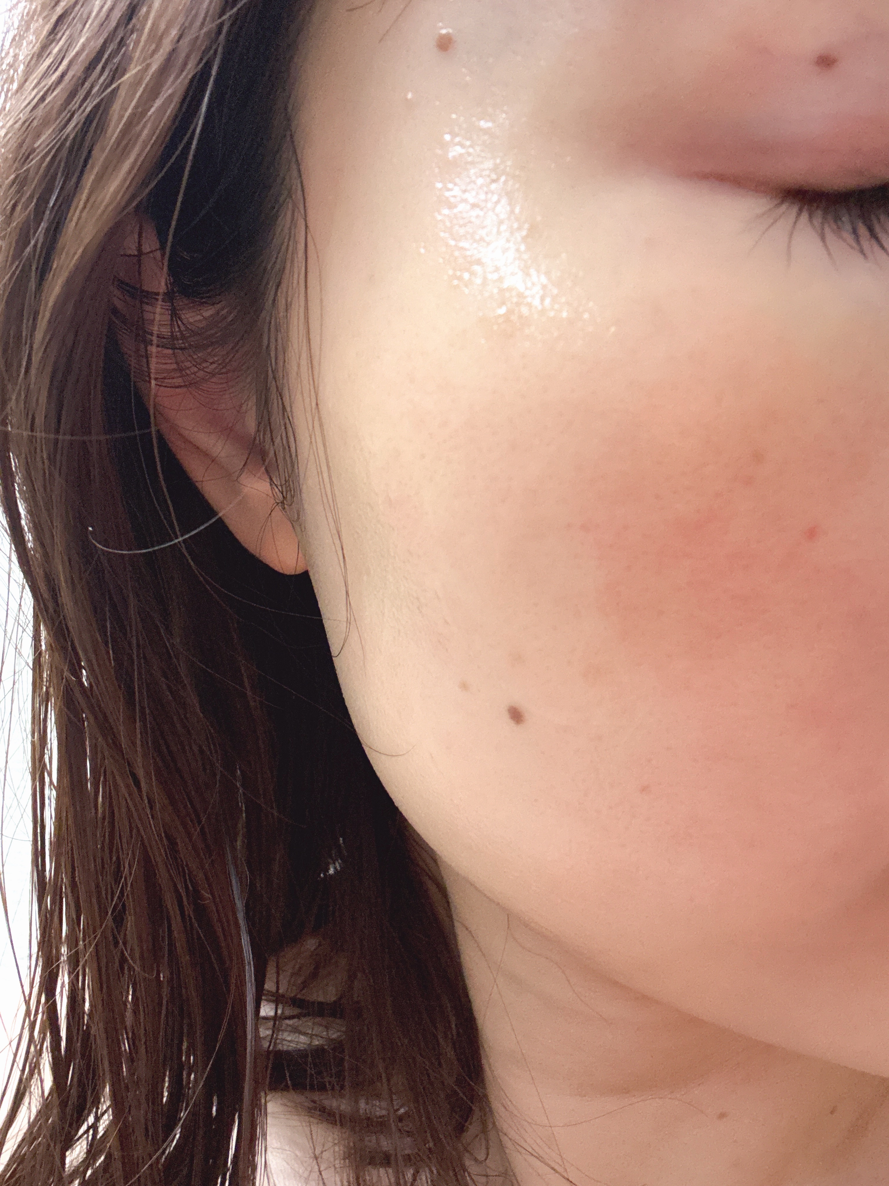 ダーマジェンシー ゼロカ81 セラム/DERMAGENCY/美容液を使ったクチコミ（2枚目）