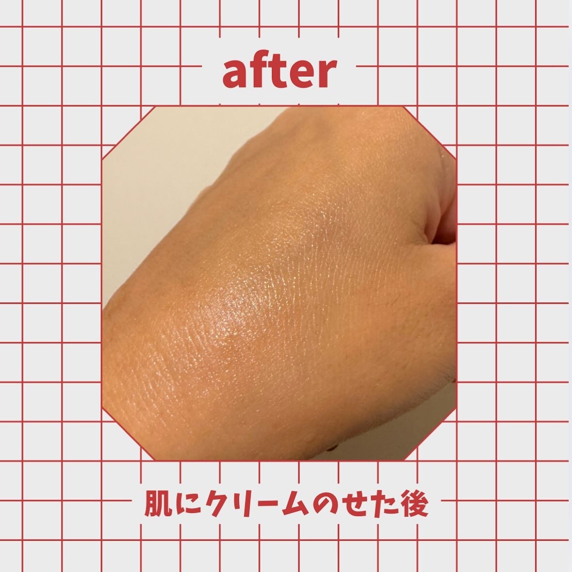 ダーマジェンシー ゼロカ81 クリーム/DERMAGENCY/フェイスクリームを使ったクチコミ(3枚目)