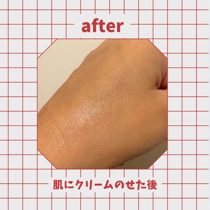 ダーマジェンシー ゼロカ81 クリーム/DERMAGENCY/フェイスクリームを使ったクチコミ(3枚目)